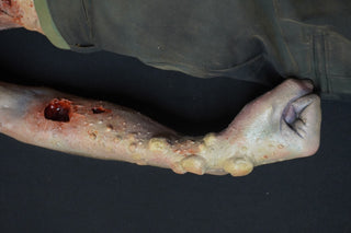 Putrefaction Blister Alan Dummy