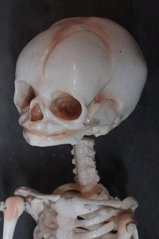 Articulated Infant Skeleton