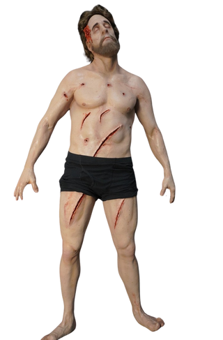 Dura Shot and Slashed Gary Body