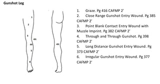 Gunshot Dura Jack Leg