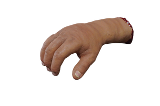 Swollen Hand