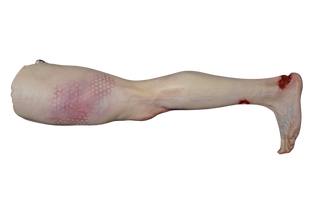 Vehicular Accident Dura Jack Leg