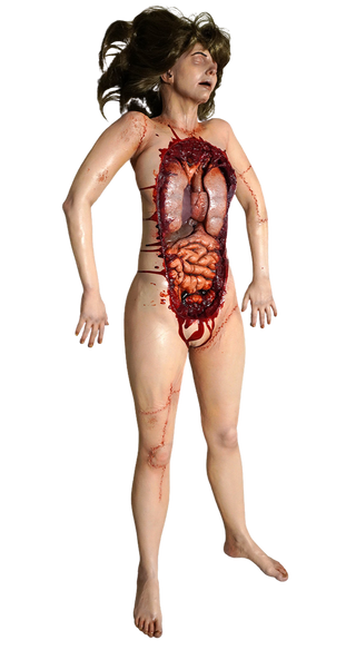 Autopsy Meredith Body with Hidden Chamber