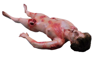 Dura Wounded Meredith Body