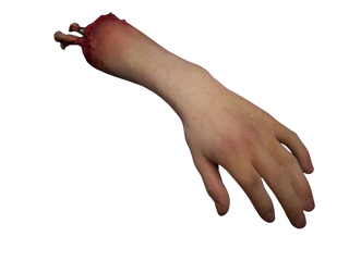 Exposed Bone Child Hand