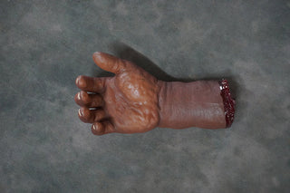 Swollen Hand