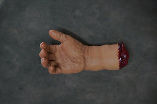 Swollen Hand