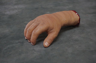 Swollen Hand