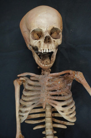 Toddler Crime Scene Skeleton