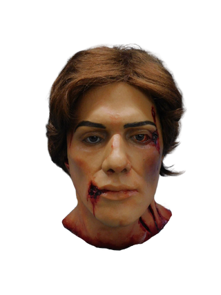 Wounded David Head