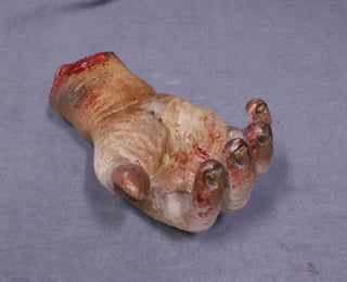 Swollen Cadaver Hand
