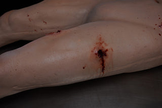 Dura Gunshot Trauma David Body