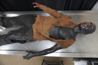 Burn Wound Richard Body