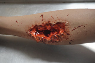 Dura Gunshot Agatha Body