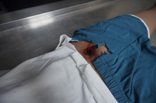 Dura Gunshot Agatha Body