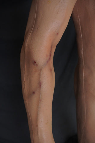 Types of Wounds Dura Jack Standing Body