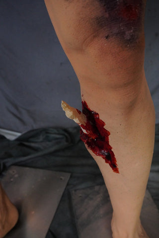 Types of Wounds Dura Jack Standing Body