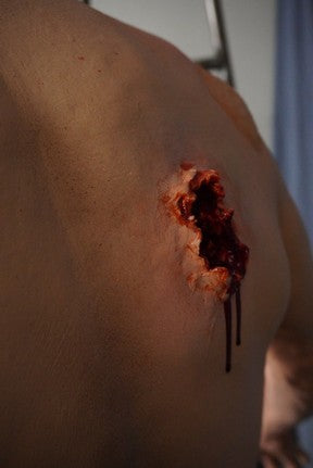 Types of Wounds Dura Jack Standing Body