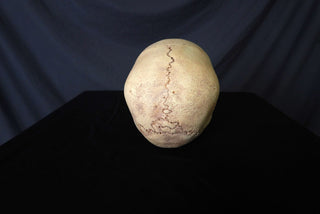 Child Skull