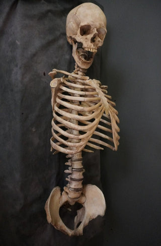 Ribcage with Lifecast Skull