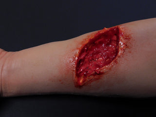 Dura Distal Laceration Kevin Hand