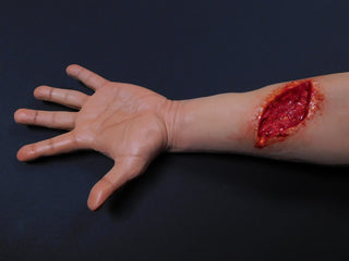 Dura Distal Laceration Kevin Hand