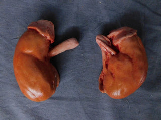 Prop Kidney Pair