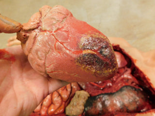 Dura Internal Disease Autopsy Jack Body