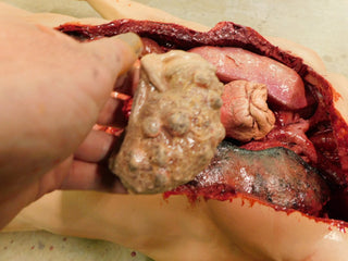 Dura Internal Disease Autopsy Jack Body