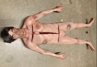 Types of Bruises Jack Dura Autopsy Body