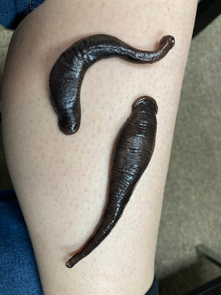 Set of 2 Silicone Leeches