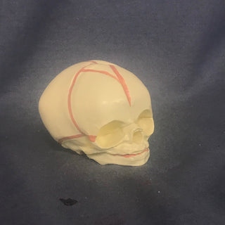 Cast Fetal Skull
