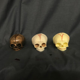 Cast Fetal Skull