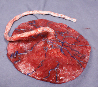 Silicone Placenta Prop