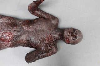 Burn Luttra Cadaver Body