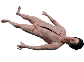 Dura Autopsy Jack Cadaver Body