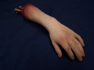 Exposed Bone Child Hand