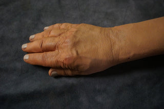 Joel Arm