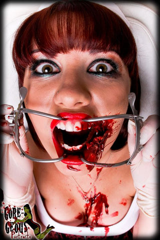 Ratchet Mouth Gag