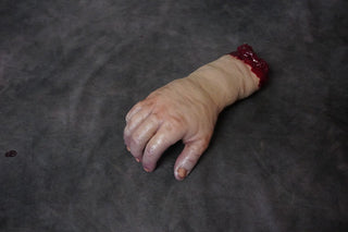 Swollen Hand