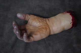 Swollen Hand