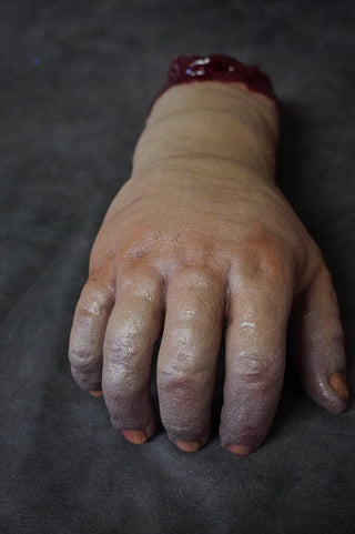 Swollen Hand