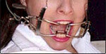 Ratchet Mouth Gag