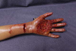 Types of Wounds Dura Yong Arm